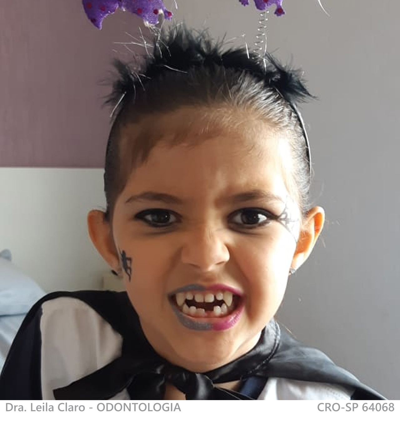 prótese temática 1