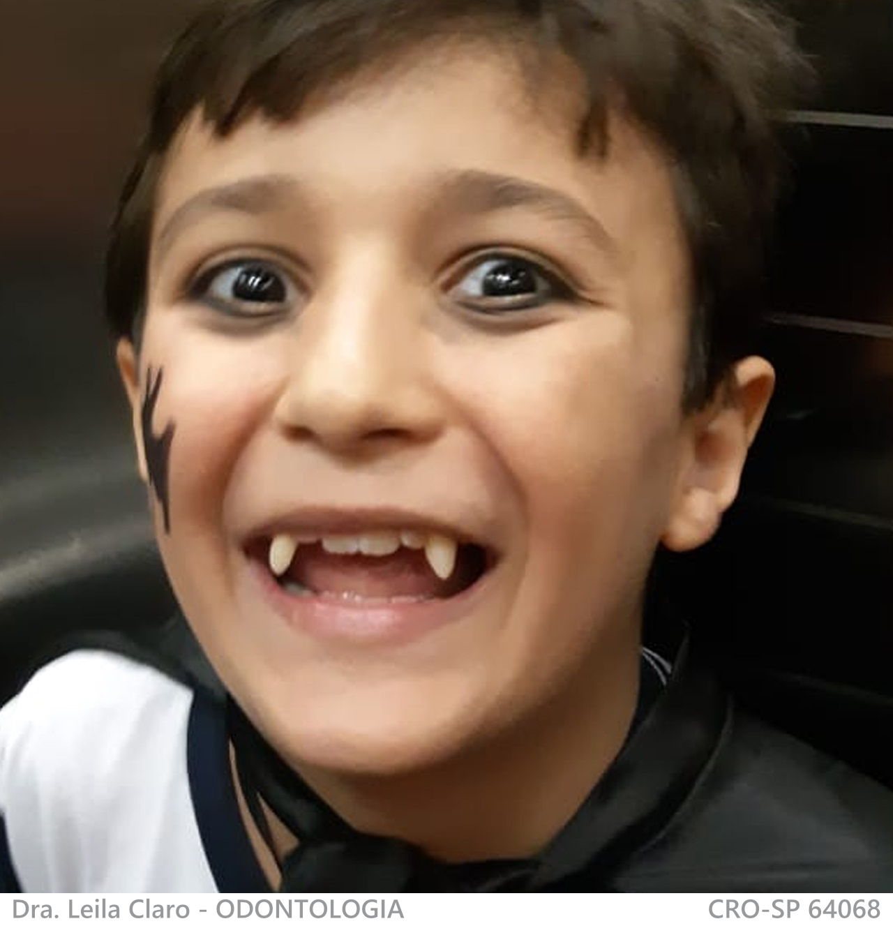 prótese temática 2